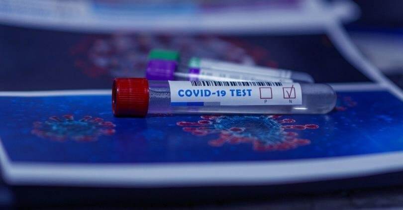 Под 40% положителни тестове за коронавирус за последното денонощие